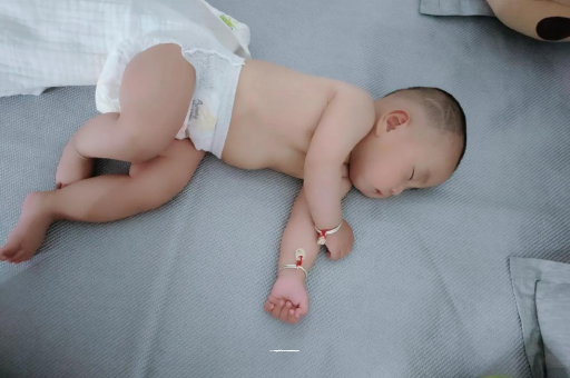 商洛六个月宝宝眼睛散光